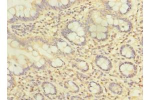 Immunohistochemistry of paraffin-embedded human small intestine tissue using ABIN7144056 at dilution of 1:100 (ZFAND2A anticorps  (AA 1-145))