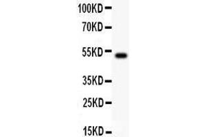Anti- IL18 Picoband antibody, Western blotting All lanes: Anti IL18  at 0. (IL-18 anticorps  (AA 36-192))