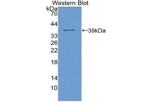 Detection of Recombinant PLN, Human using Polyclonal Antibody to Phospholamban (PLN)