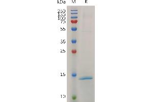 Mouse RN Protein, His Tag on SDS-PAGE under reducing condition.
