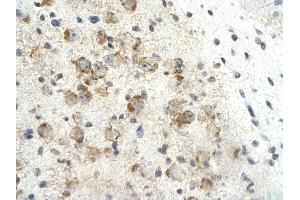 Rabbit Anti-MORF4L2 Antibody       Paraffin Embedded Tissue:  Human neural cell   Cellular Data:  Epithelial cells of renal tubule  Antibody Concentration:   4.