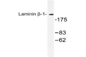 Western blot (WB) analysis of Laminin beta-1 antibody in extracts from HepG2 cells. (Laminin beta 1 anticorps)