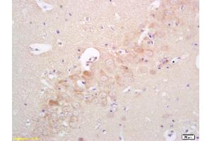 Formalin-fixed and paraffin embedded rat brain labeled with Rabbit Anti phospho-IRAK4(Thr345)Polyclonal Antibody, Unconjugated (ABIN753538) at 1:200 followed by conjugation to the secondary antibody and DAB staining (IRAK4 anticorps  (pThr345))