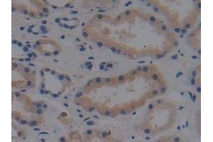 Detection of MAP3K1 in Human Kidney Tissue using Polyclonal Antibody to Mitogen Activated Protein Kinase Kinase Kinase 1 (MAP3K1)