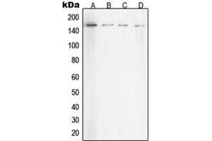 Western blot analysis of ROCK1 expression in HeLa (A), NIH3T3 (B), C6 (C), COS7 (D) whole cell lysates. (ROCK1 anticorps  (Center))