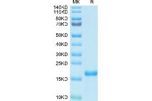 SARS-CoV-2 Nucleocapsid (SARS-CoV-2 N) (AA 64-180) protein (His-Avi Tag)