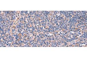 Immunohistochemistry of paraffin-embedded Human tonsil tissue using MPP1 Polyclonal Antibody at dilution of 1:50(x200)