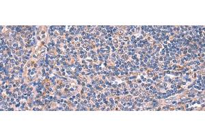 Immunohistochemistry of paraffin-embedded Human tonsil tissue using MPP1 Polyclonal Antibody at dilution of 1:50(x200) (MPP1 anticorps)