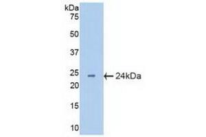Detection of Recombinant CRYbB2, Mouse using Polyclonal Antibody to Crystallin Beta B2 (CRYbB2) (CRYbB2 anticorps  (AA 17-191))