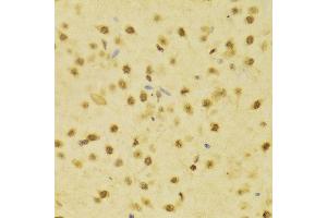 Immunohistochemistry of paraffin-embedded Rat brain using RBFOX3 antibody at dilution of 1:100 (x400 lens). (NeuN anticorps)