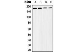 Western blot analysis of BAF170 expression in Raji (A), MCF7 (B), mouse liver (C), rat liver (D) whole cell lysates. (SMARCC2 anticorps  (Center))