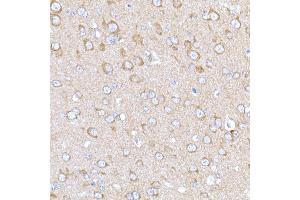 Immunohistochemistry of paraffin-embedded mouse brain using M Rabbit pAb (ABIN3021414, ABIN3021415, ABIN3021416 and ABIN6215021) at dilution of 1:500 (40x lens).