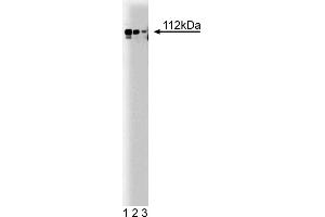 Western Blotting (WB) image for anti-Adaptor-Related Protein Complex 2, alpha 1 Subunit (AP2A1) (AA 38-215) antibody (ABIN968009) (alpha Adaptin anticorps  (AA 38-215))
