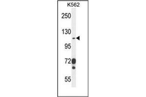 Western blot analysis of CD103 Antibody (C-term) in K562 cell line lysates (35ug/lane). (CD103 anticorps  (C-Term))