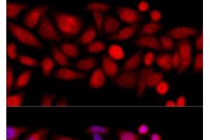 Immunofluorescence analysis of HeLa cells using KIF4A Polyclonal Antibody at dilution of 1:100 (40x lens).