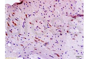 Formalin-fixed and paraffin embedded rat brain labeled with Anti-Sema3F/semaphorin 3F Polyclonal Antibody, Unconjugated (ABIN737976) at 1:200 followed by conjugation to the secondary antibody and DAB staining.