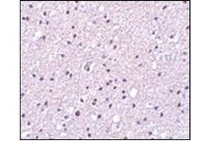 anti-Protease, serine, 12 (Neurotrypsin, Motopsin) (PRSS12) (N-Term) antibody