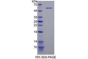 Image no. 1 for phosphodiesterase 4D, cAMP-Specific (PDE4D) (AA 581-809) protein (His tag,GST tag) (ABIN4990451) (PDE4D Protein (AA 581-809) (His tag,GST tag))