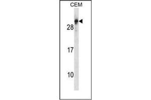 Western blot analysis of RGS5 Antibody (N-term) in CEM cell line lysates (35ug/lane). (RGS5 anticorps  (N-Term))