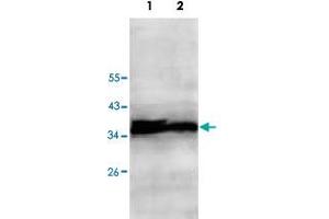 Western blot analysis of HepG2 (Lane 1) and Jurkat (Lane 2) cell lysate with ECH1 polyclonal antibody  at 1 : 500 dilution. (ECH1 anticorps  (AA 145-325))