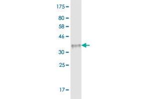 Western Blot detection against Immunogen (31.