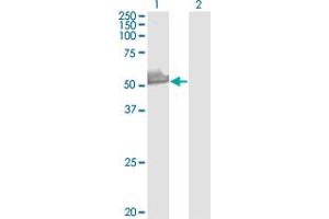 Western Blot analysis of PRPF19 expression in transfected 293T cell line by PRPF19 monoclonal antibody (M07), clone 2E5.