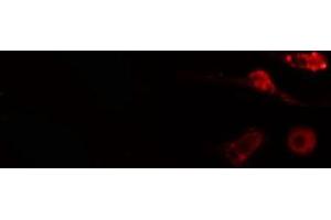 ABIN6275036 staining  COLO205 cells by IF/ICC. (NCAPH anticorps  (Internal Region))