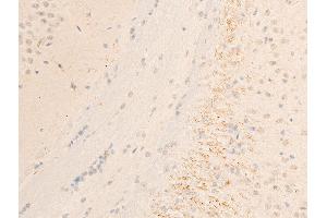 ABIN6267071 at 1/100 staining mouse brain tissue sections by IHC-P.