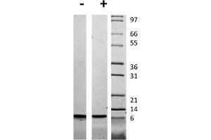 SDS-PAGE of Human Insulin-like Growth Factor II Recombinant Protein SDS-PAGE of Human Insulin-like Growth Factor II Recombinant Protein.