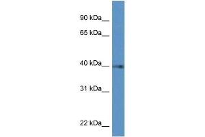 Western Blot showing PTGDR antibody used at a concentration of 1 ug/ml against Hela Cell Lysate (PTGDR anticorps  (C-Term))