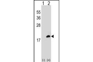Western blot analysis of COTL1 (arrow) using rabbit polyclonal COTL1 Antibody (C-term) (ABIN652766 and ABIN2842503). (COTL1 anticorps  (C-Term))