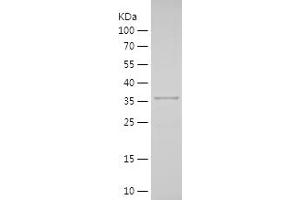 Western Blotting (WB) image for SRY (Sex Determining Region Y)-Box 17 (SOX17) (AA 218-414) protein (His tag) (ABIN7125199)