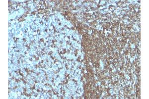 Formalin-fixed, paraffin-embedded human Tonsil stained with CD50 Monoclonal Antibody (SPM505)
