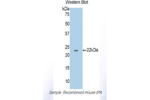Detection of Recombinant tPA, Mouse using Polyclonal Antibody to Tissue Plasminogen Activator (tPA)