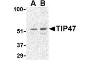 Western blot analysis of TIP47 in Daudi cell lysate with this product at (A) 0. (PLIN3 anticorps  (C-Term))