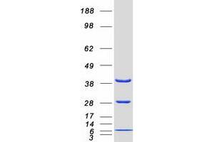 Validation with Western Blot