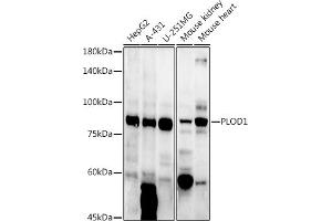 Western blot analysis of extracts of various cell lines, using PLOD1 antibody (ABIN6127272, ABIN6145784, ABIN6145786 and ABIN6223913) at 1:1000 dilution. (PLOD1 anticorps  (AA 488-727))