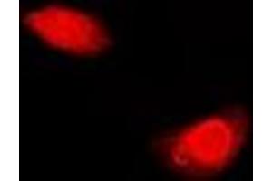 Immunofluorescent analysis of Periplakin staining in U2OS cells.