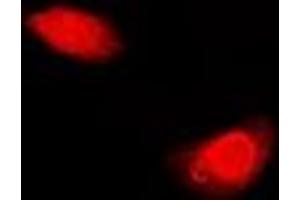 Immunofluorescent analysis of Periplakin staining in U2OS cells. (PPL anticorps)