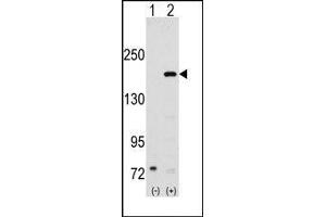 Western blot analysis of SRC1 (arrow) using rabbit polyclonal SRC1 Antibody (NCOA1 anticorps  (N-Term))