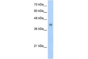 WB Suggested Anti-VSIG4 Antibody Titration:  5. (VSIG4 anticorps  (N-Term))
