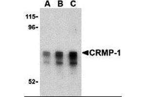 Western Blotting (WB) image for anti-Collapsin Response Mediator Protein 1 (CRMP1) (Middle Region) antibody (ABIN1030908)