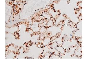 ABIN6267502 at 1/200 staining Rat lung tissue sections by IHC-P.