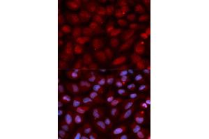Immunofluorescence (IF) image for anti-CD47 (CD47) (AA 20-140) antibody (ABIN3022624)