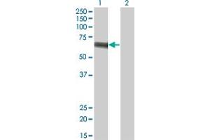 Western Blot analysis of SLC5A2 expression in transfected 293T cell line by SLC5A2 monoclonal antibody (M01), clone 3G8.