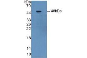WB of Protein Standard: different control antibodies  against Highly purified E. (Adiponectin Receptor 2 Kit ELISA)