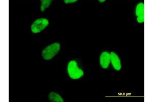 Immunofluorescence of monoclonal antibody to CTNNBL1 on HeLa cell.