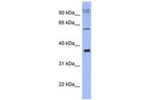 Image no. 1 for anti-BTB (POZ) Domain-Containing Protein KCTD4 (KCTD4) (AA 35-84) antibody (ABIN6741637) (KCTD4 anticorps  (AA 35-84))