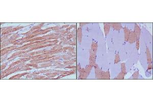 Immunohistochemical analysis of paraffin-embedded human skeletal muscle (left) and cardiac muscle (right) using MYL3 antibody with DAB staining. (MYL3/CMLC1 anticorps)