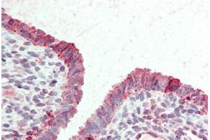 Anti-STEAP2 antibody  ABIN960821 IHC staining of human uterus. (STEAP2 anticorps  (Internal Region))